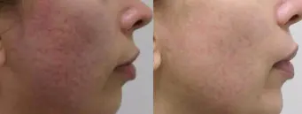 before-after-img1